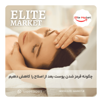 چگونه قرمز شدن پوست بعد از اصلاح را با محصولات خانگی کاهش دهیم