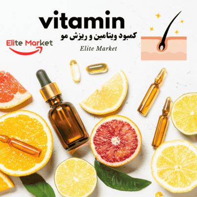 کمبود ویتامین و ریزش مو