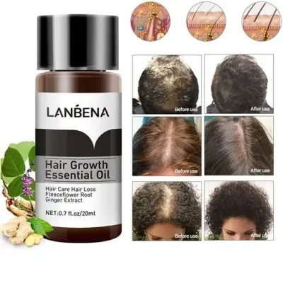 روغن تقویت و رشد مو لانبنا مناسب ضد ریزش مو و ضخیم کننده تارهای مو